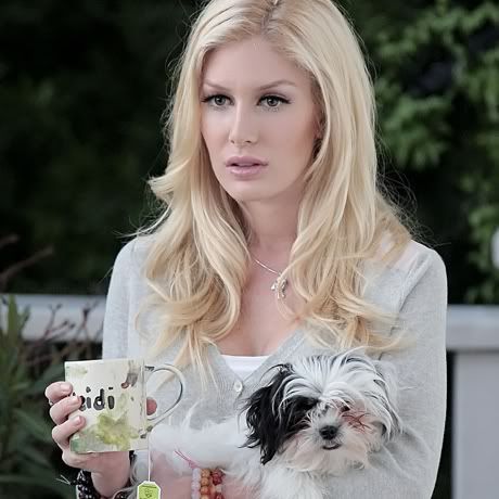 heidi montag surgery disaster. heidi montag after surgery.